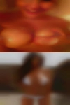 Butt injections horny women